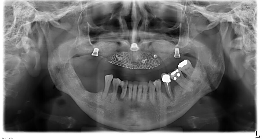 Fig. 18