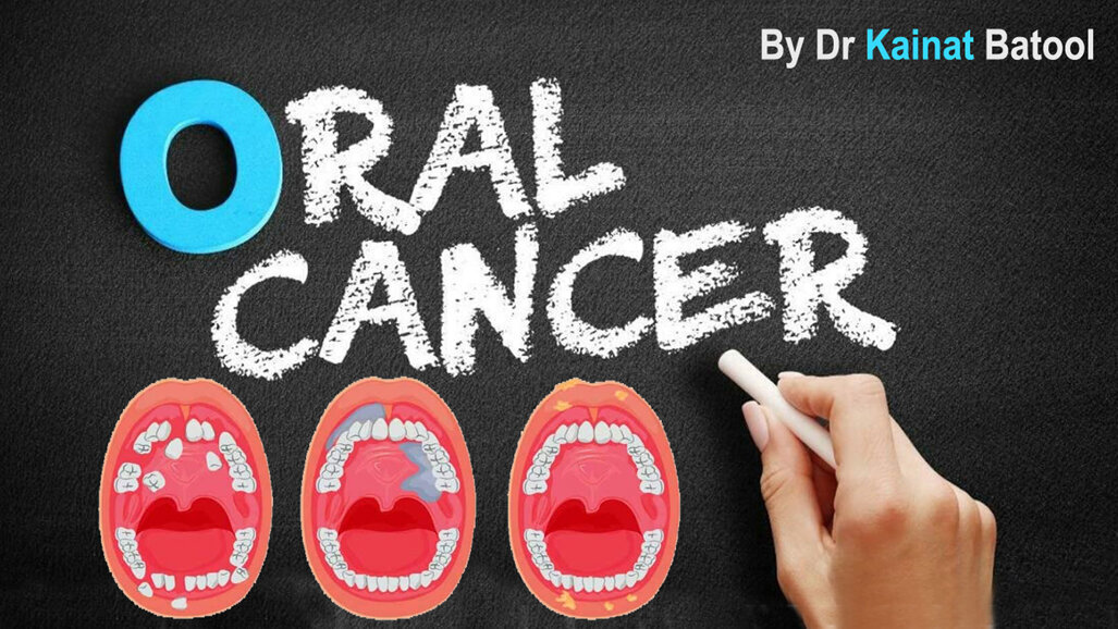 A gender-based perspective on rising oral cancer threat  