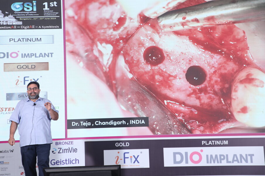 Fig 27: Industrial symposium - Simplified approach for pneumatized & severely resorbed maxilla by Dr Jasbinder Singh Teja from Dentium