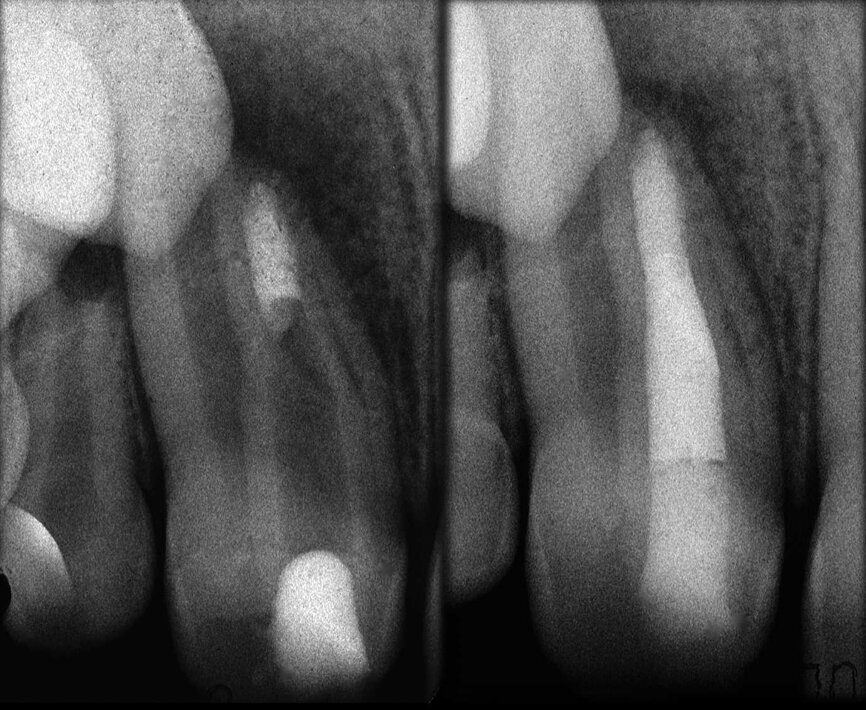 Figure 36