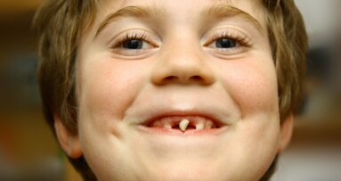 Bijna één op de vijf kinderen niet naar tandarts