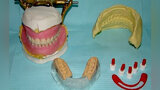 Fig. 30. Todo lo necesario previo a la cirugía y colocación de los implantes dentales: encerado diagnóstico, prueba estética, guía quirúrgica, guías de mordida, postes de impresión modificados, Guía vestibular de Putty, barra de Duralay® OSU.