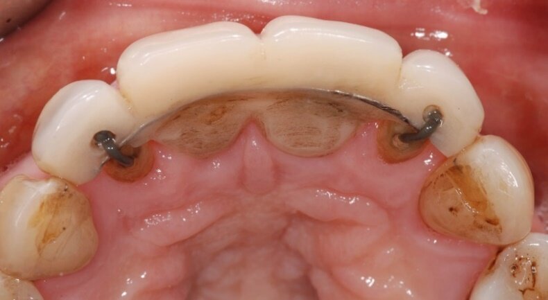 Fig. 6