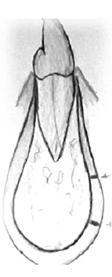 Aloinjerto1
