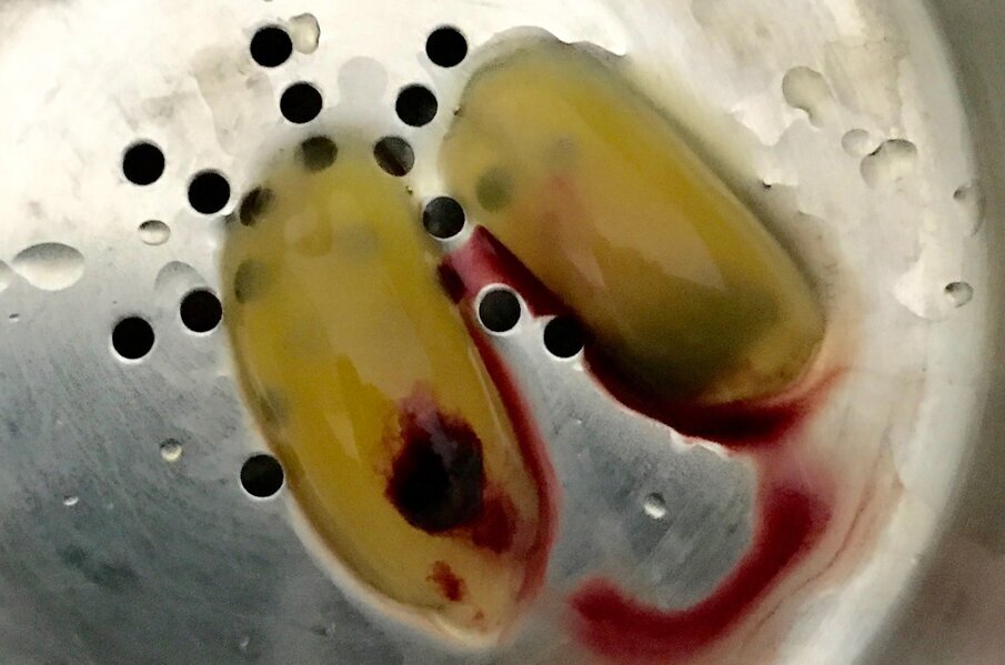 Fig. 9 - A-PRF.