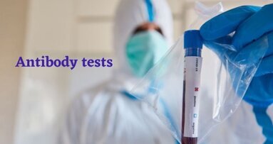 COVID-19 antibody tests not recommended for measuring immunity after vaccination