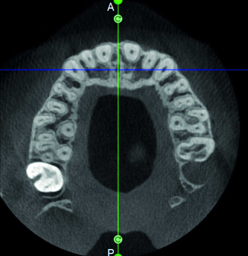 Figure 13