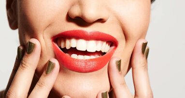 Dentists to TikTokers: Stop viral ‘teeth scaling’ trend at home
