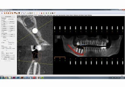 Invivo 5.4