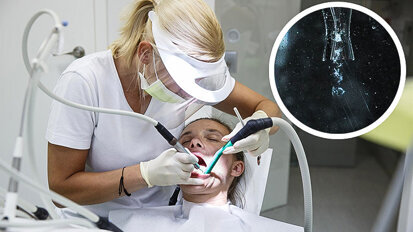 Cavitating jets may provide easier removal of oral biofilm