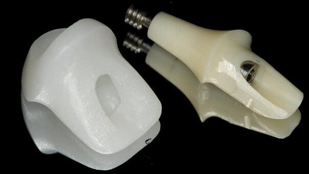 Implantology—the perfect art of camouflage thanks to CAD/CAM