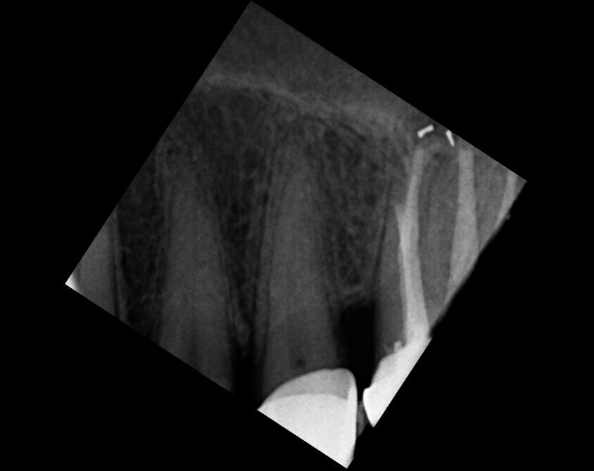 Fig. 18