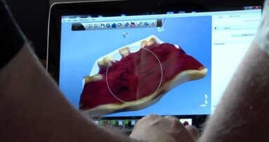 מכשיר סריקה הולוגרפית 3-D מקצר תהליך הולם תותבת באופן משמעותי