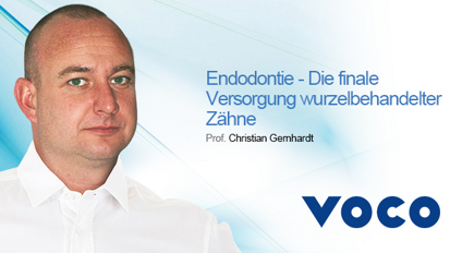 Live-Webinar: Endodontie – Finale Versorgung wurzelbehandelter Zähne