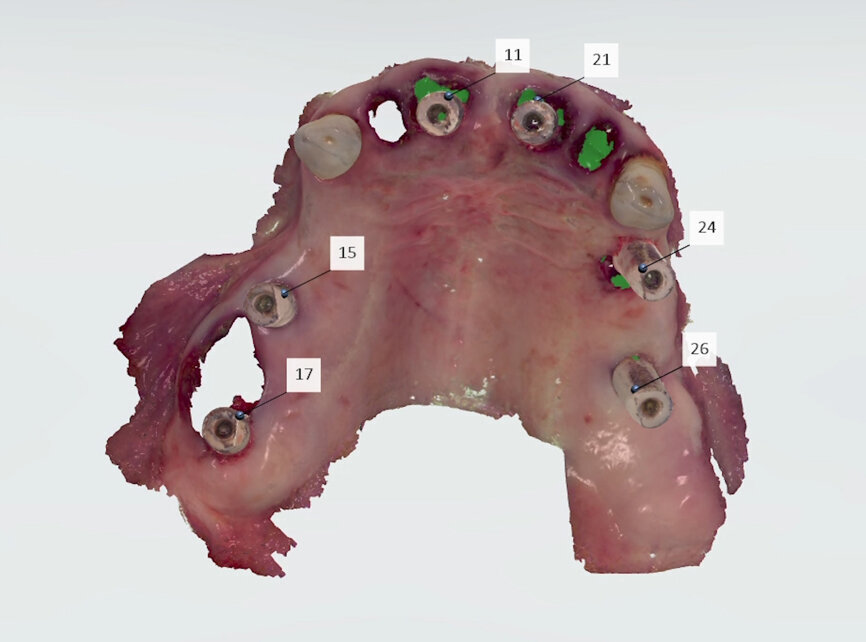 Fig. 12