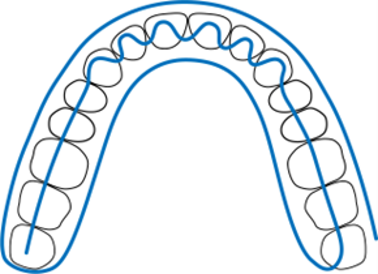 Fig. 5: Standard scanning strategy when using an intra-oral scanner to take a full-arch scan.