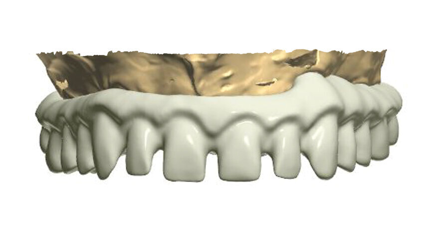 Fig. 3: Ready-made construction on a virtual model.