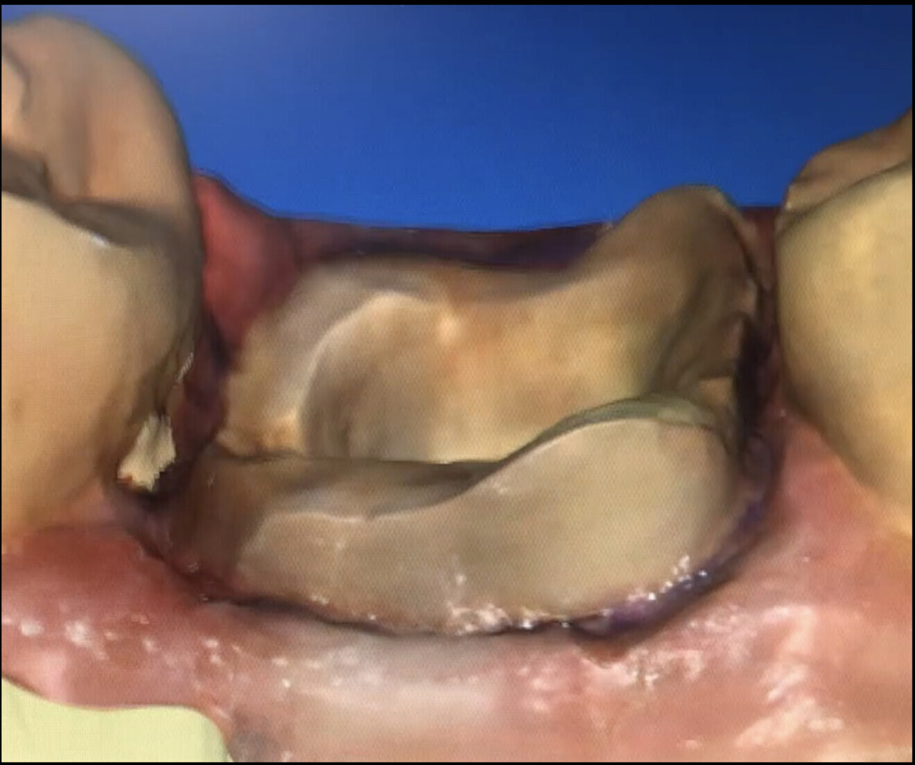 Fig. 12b.