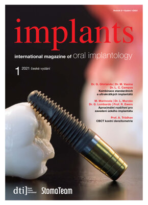 implants Czech Republic No. 1, 2021