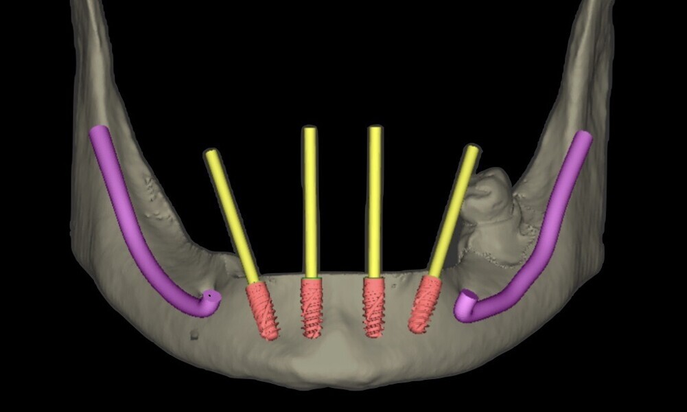 Fig. 19