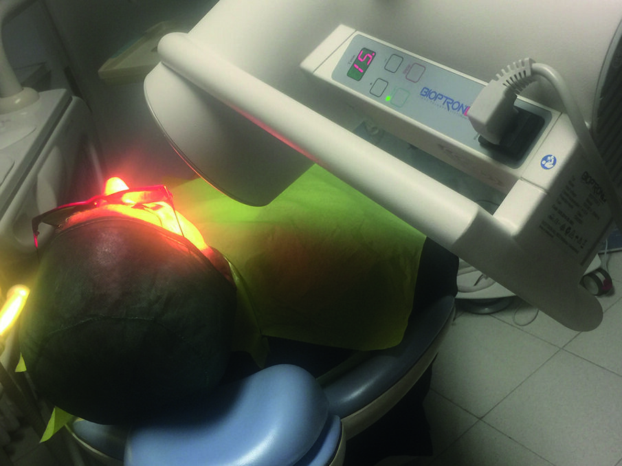 Fig. 4a