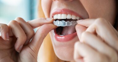 Webinar to focus on advanced digital visualisation tools for aligner treatment