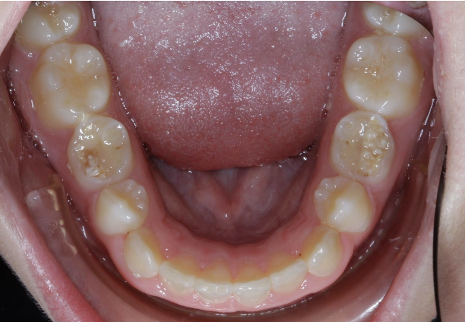 Fig. 33
