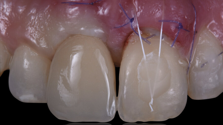 Fig. 13