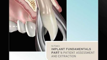 Hu-Friedy releases guide to implantology