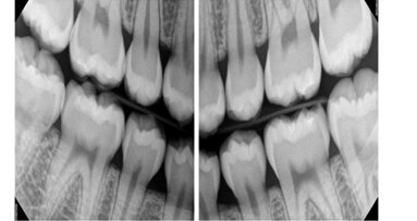 Wireless digital radiography system earns tech award