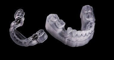 Digitalisation of the gold standard of implantology
