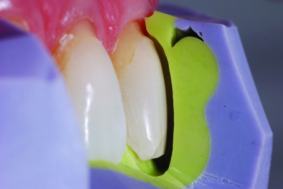 Fig. 6a