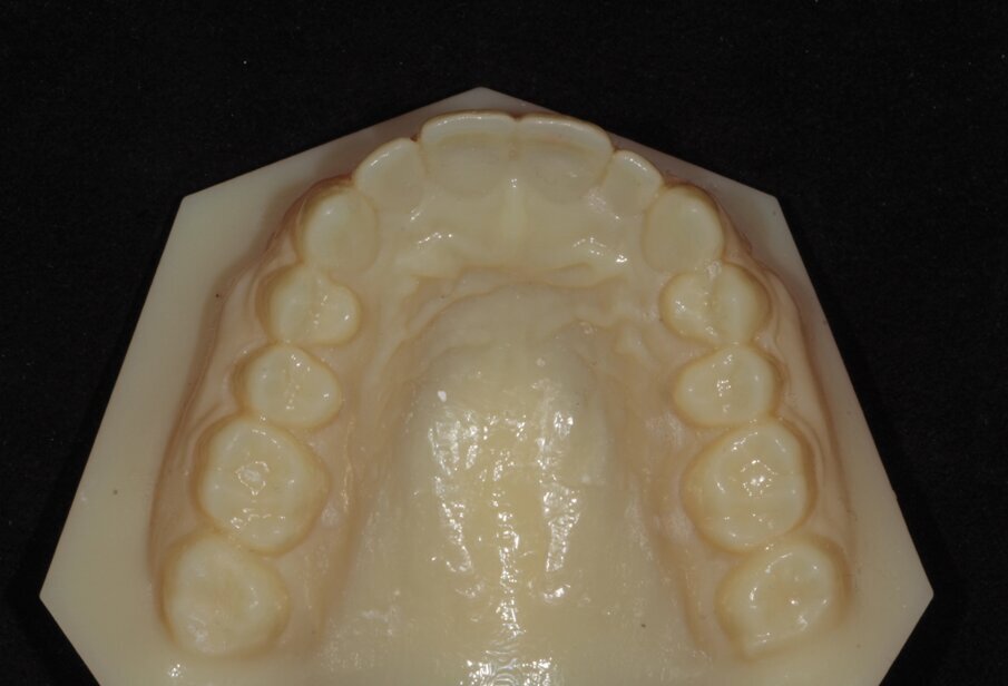 10. 3D-print verwachte eindsituatie