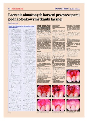 DT Poland
