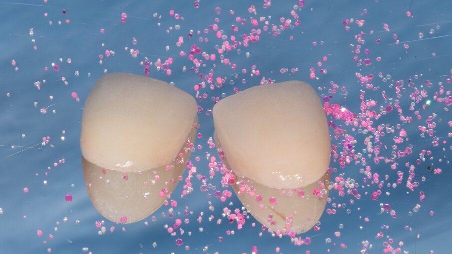 Cleaning metal-free fixed dental restorations prior to bonding procedures_Fig.2