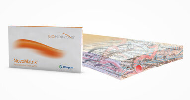 Next generation of tissue augmentation: Performance and safety of NovoMatrix