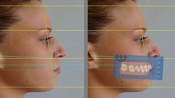 Dentofacial aesthetic analysis using 3-D software—Synergy between aesthetic dentistry and aesthetic medicine