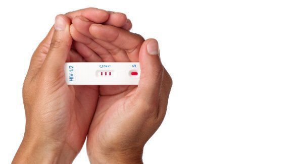 Połowa osób zakażonych wirusem HIV nie wie o swojej chorobie
