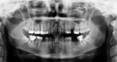 Kurs ochrony radiologicznej typu S dla lekarzy i lekarzy dentystów