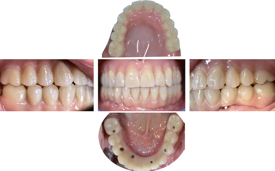 Fig. 22