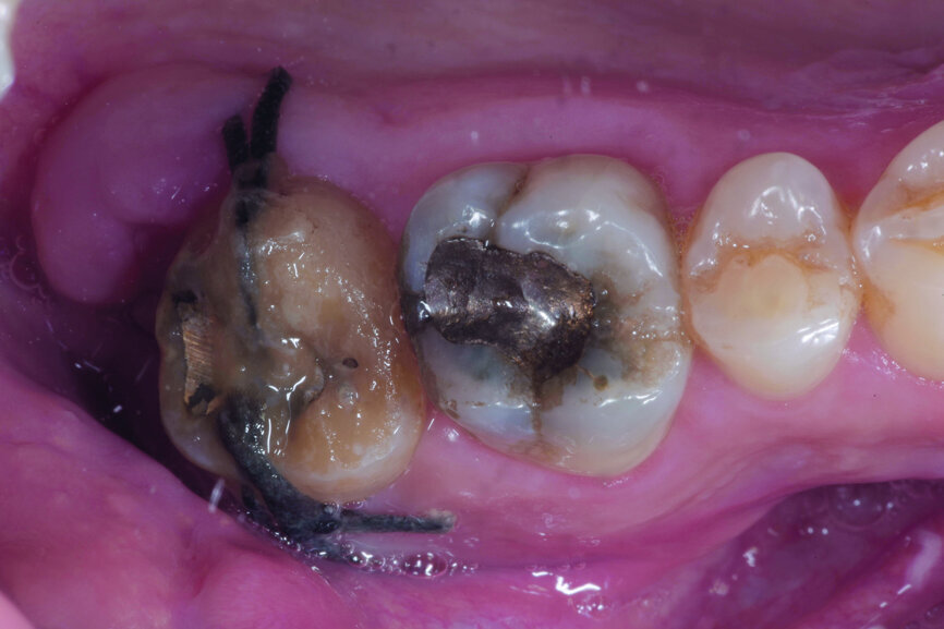 Fig. 10: Two weeks after transplantation.