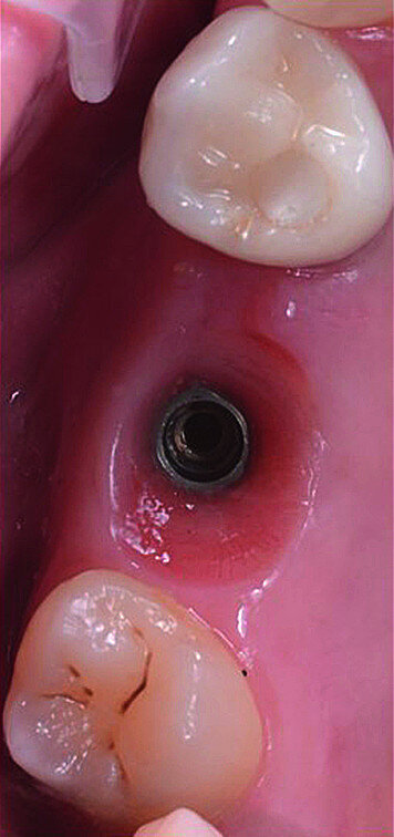 Fig. 15b