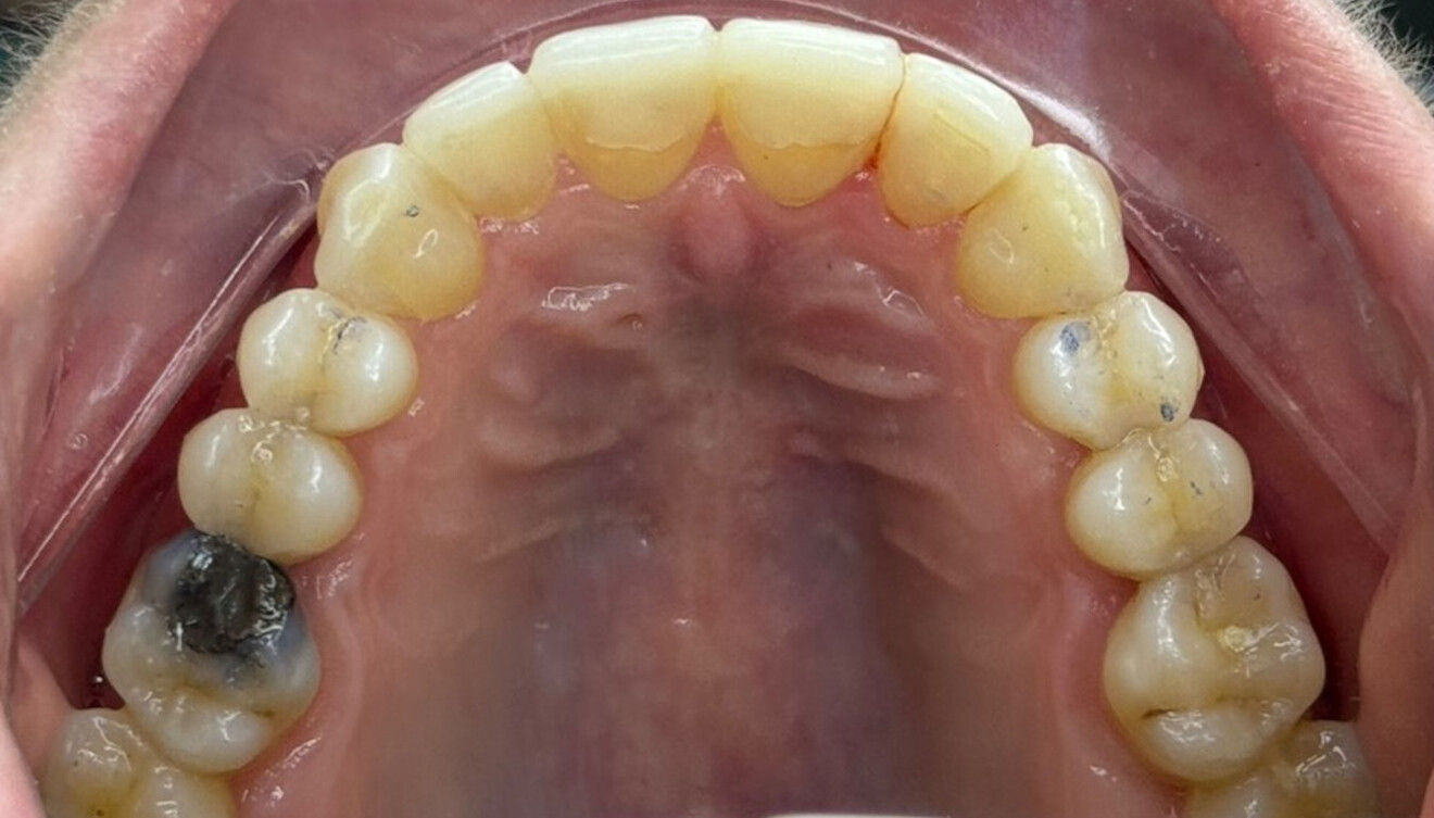 Fig. 6c