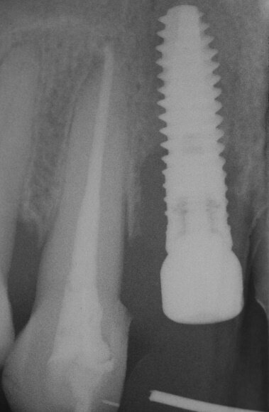 Fig. 17