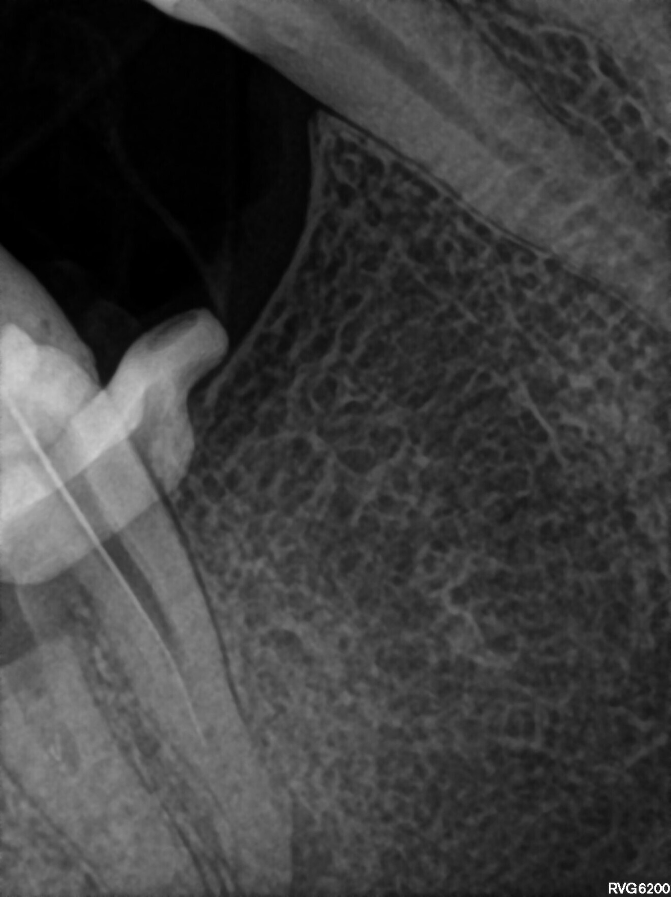 Fig. 18