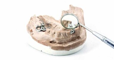 Verwendung von Cobalt in Dentallegierungen gerechtfertigt