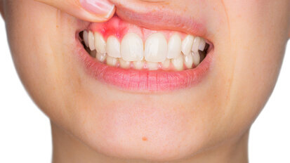 Study of 50 years of literature on periodontitis reveals obvious link
