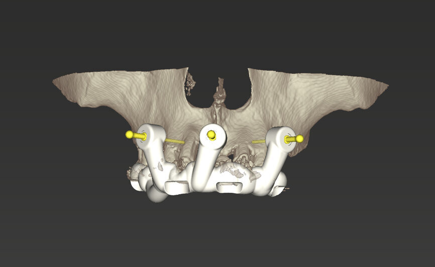 Fig. 10