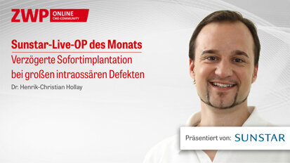Im Archiv abrufbar: Sunstar Live-OP mit Dr. Henrik-Christian Hollay