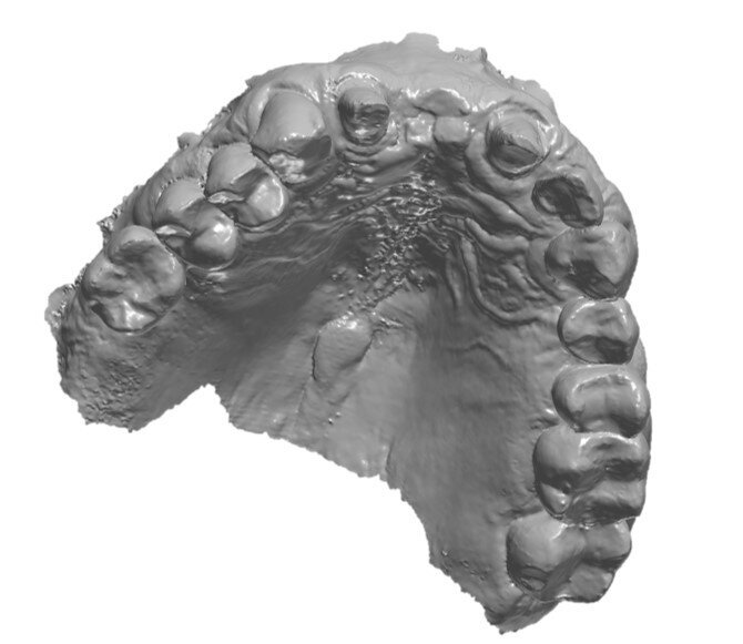 Fig. 3_Scansione intraorale dell’arcata (DEXIS IS 3800w, DEXIS), visione occlusale.